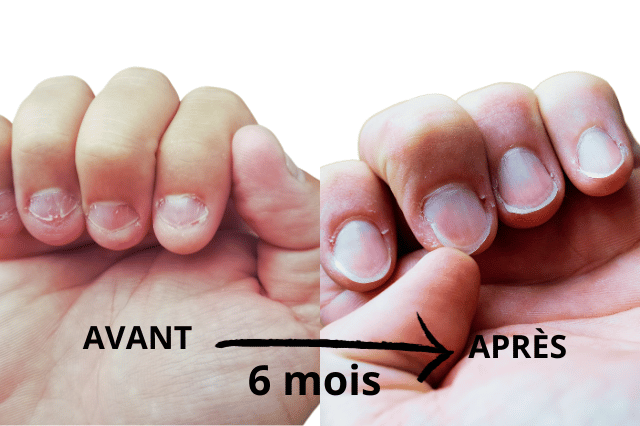 ongles-ronges-avant-apres